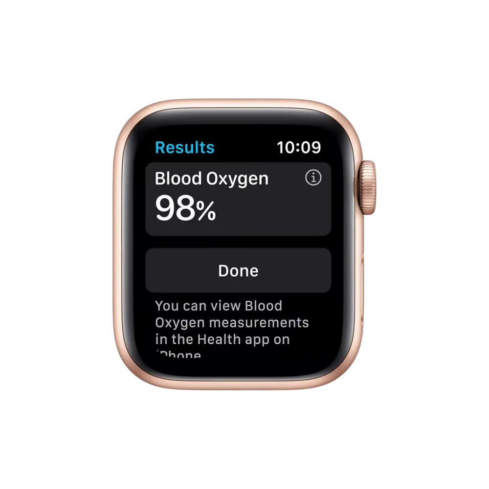 Affichage niveau de batterie Apple Watch Série 6 40mm. Changement batterie, réparation écran, bouton ou cache arrière chez iTelier à Lyon, Vénissieux, Chaponost, Sainte-Foy-lès-Lyon.